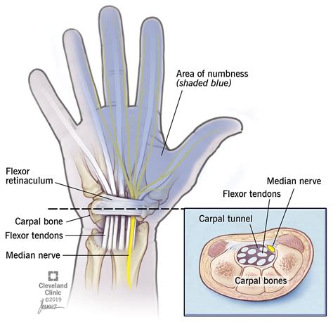 motor function carpal tunnel